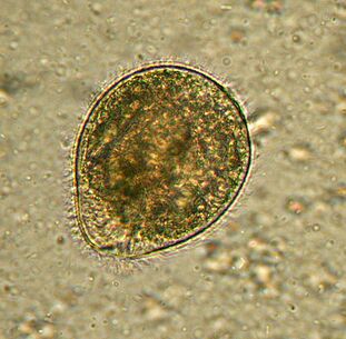 Balantidium is the largest protozoal parasite