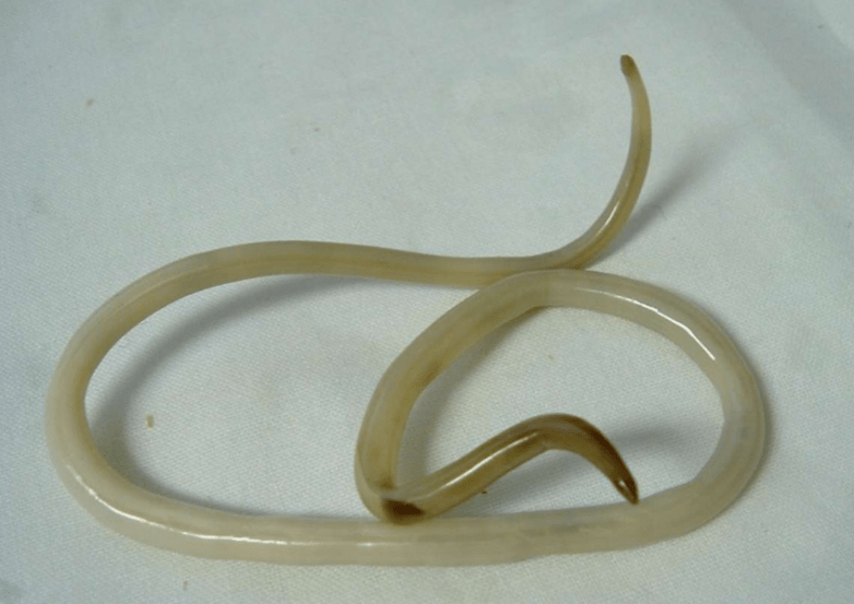 Worm from the human body and its treatment
